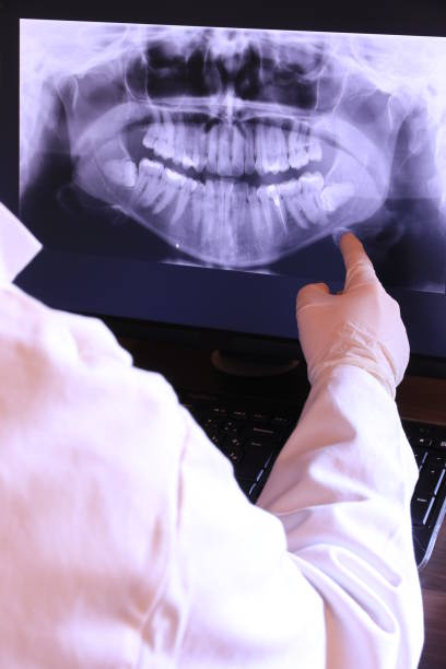 Best Emergency TMJ Treatment in Lake Mills, WI
