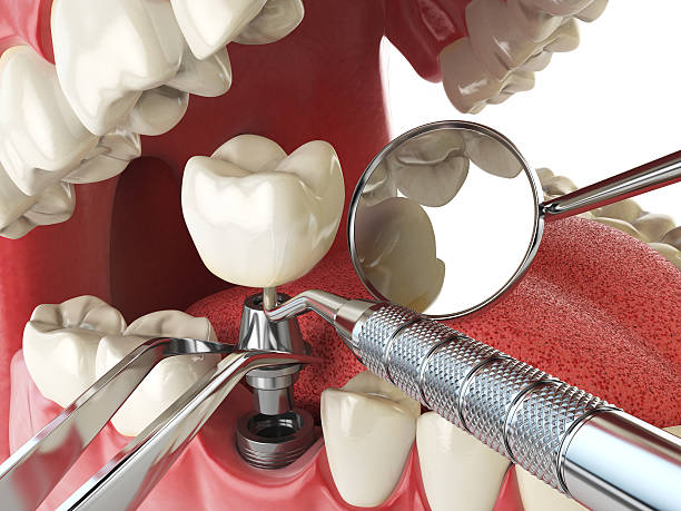 Best Weekend Emergency Dentist in Lake Mills, WI