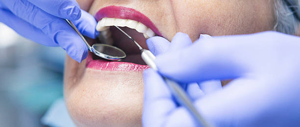 Best Emergency Gum Treatment in Lake Mills, WI