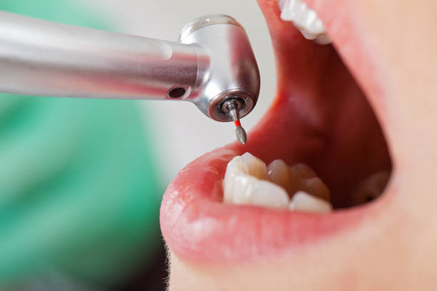 Best Cosmetic Emergency Dentistry in Lake Mills, WI